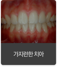 �������� ġ��