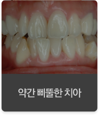 �ణ �߶��� ġ��