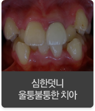 ���ѵ��� ���������� ġ��