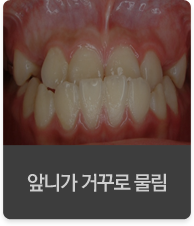 �մϰ� �Ųٷ� ����