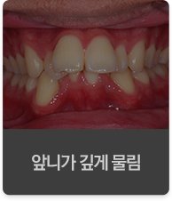 �մϰ� ��� ����