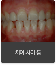 ġ�� ���� ƴ